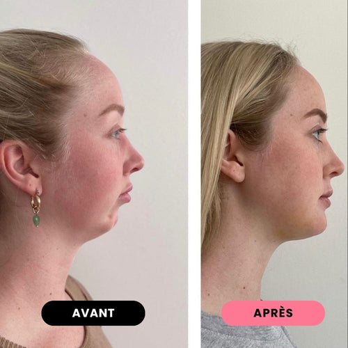 JAWLINA®｜Chewing-gum dur jawline - Bubble Gum