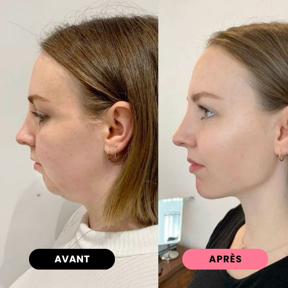JAWLINA®｜Chewing-gum dur jawline - Menthe