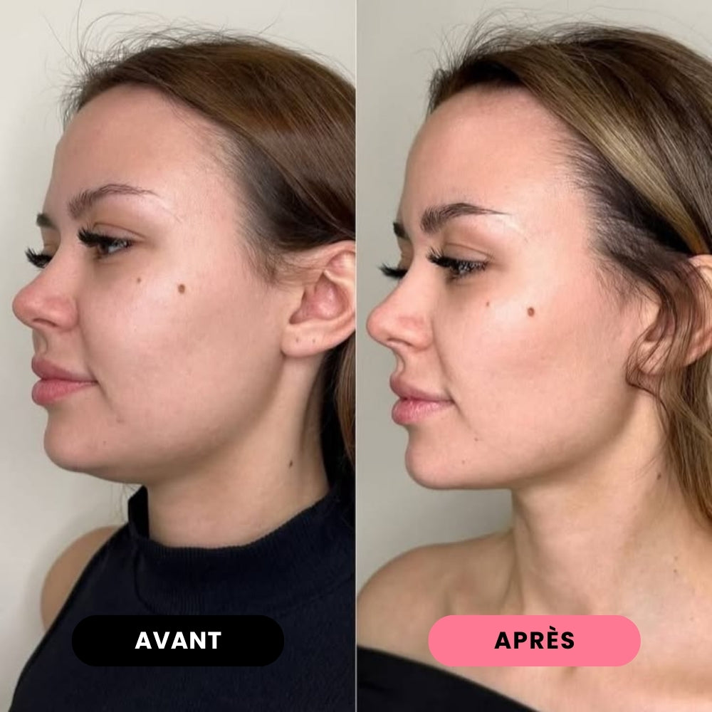 JAWLINA®｜Chewing-gum dur jawline - Menthe